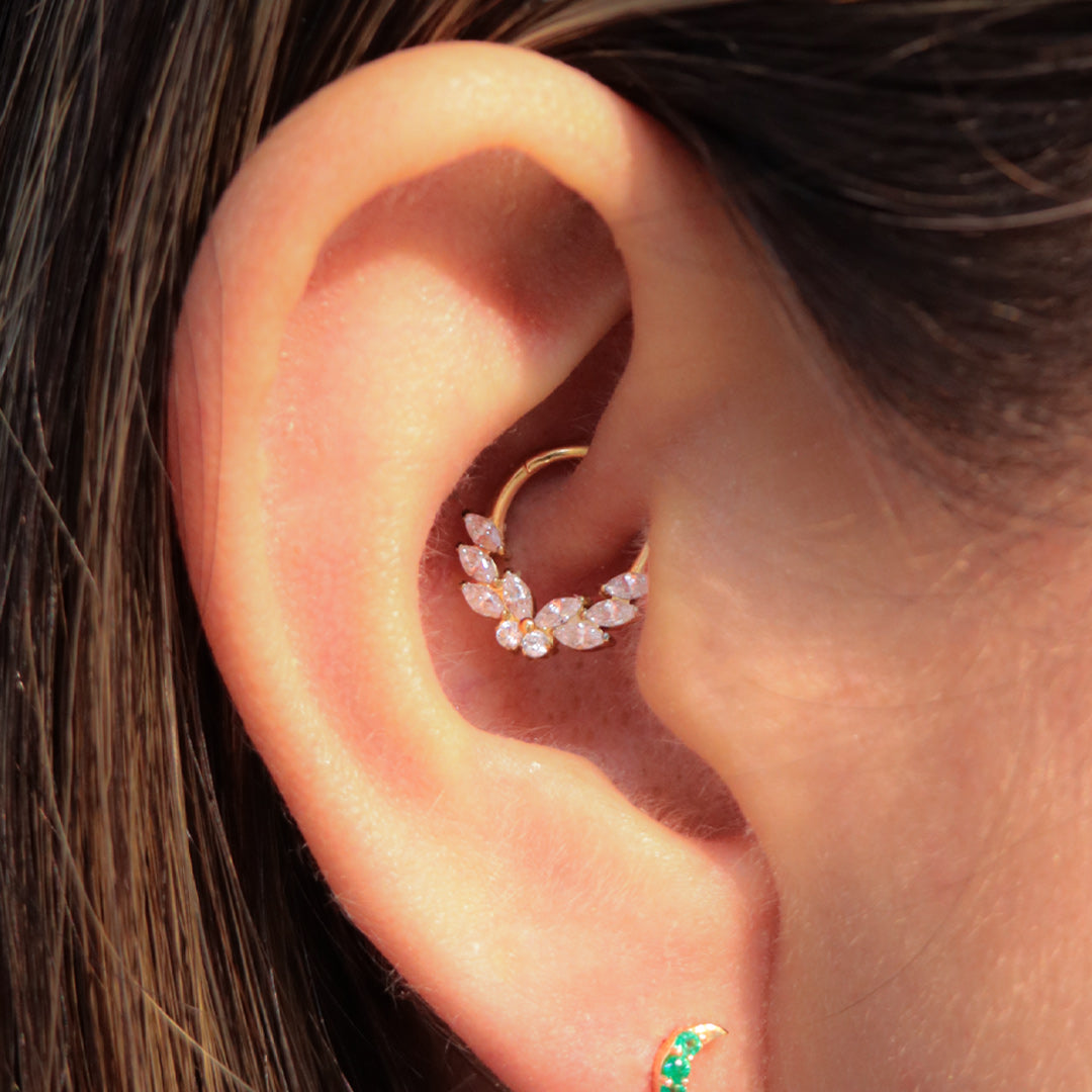 Aro Clicker Alas de Ángel en Titanio Grado Implante con Zirconias